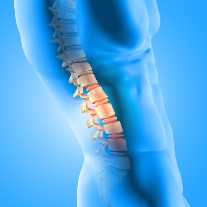 Ankylosing Spondylitis happens on the lower back