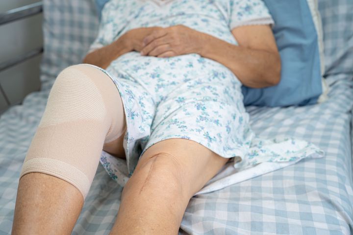 An adult or senior with bandages around their right knee lying on bed in hospital clothes and what seems to be a scar longitudinally on the knee of the left leg.