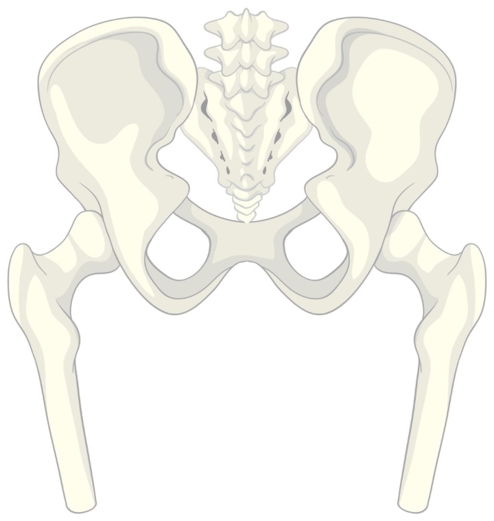 Slipped Capital Femoral Epiphysis Scfe with the anatomy of the hip