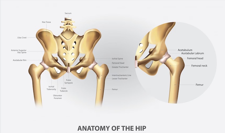 An illustration showing and labeling the bones of the hip as well as each of their parts, with a view of the right hip viewed closer.