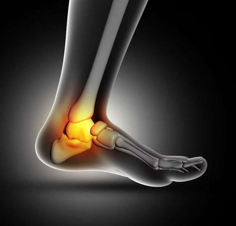 Treatment Options for Foot and Ankle Arthritis