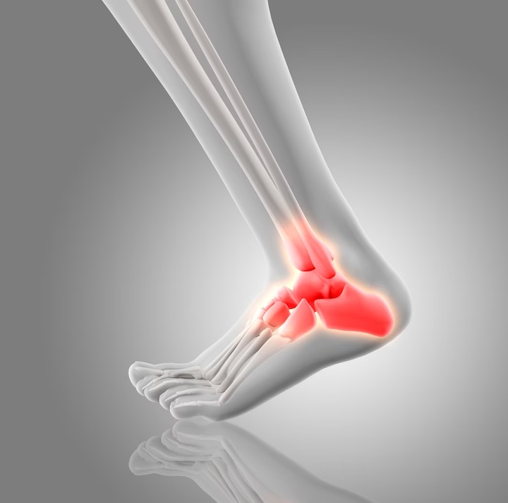 An illustration of where ankle pain can occur showing all the bones related to the ankle in red.