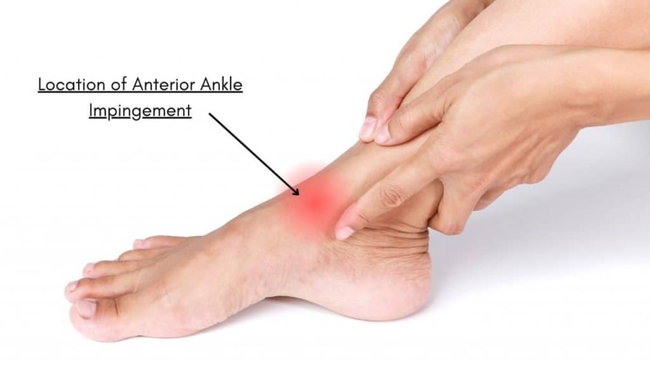 Causes of Anterior Ankle Impingement