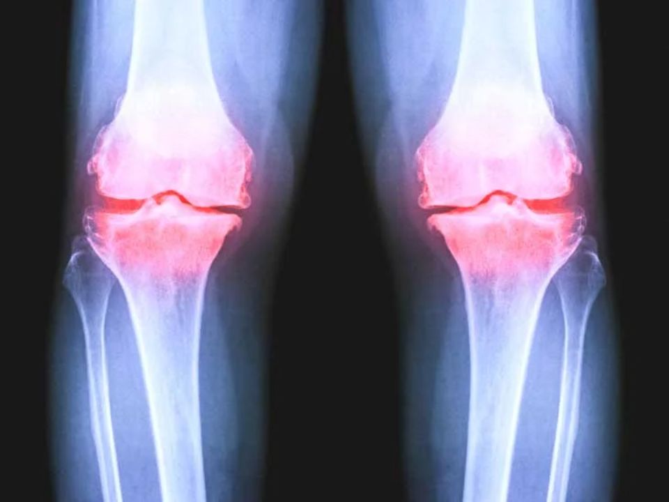An X-ray output of a knee of a person with the knee joint marked in red.