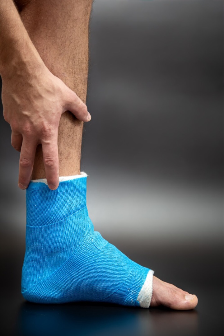tibialis posterior being treated with splint