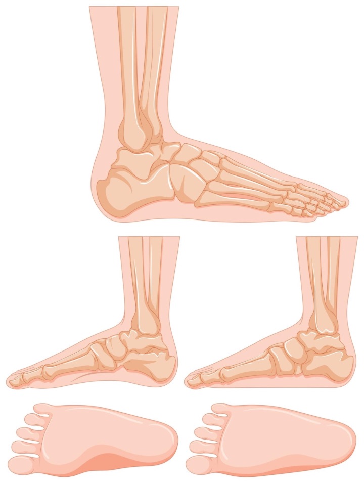 peroneal tendonitis can be caused by biological changes