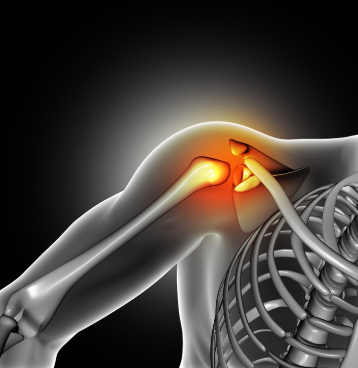 dislocated shoulder joint pain illustrated