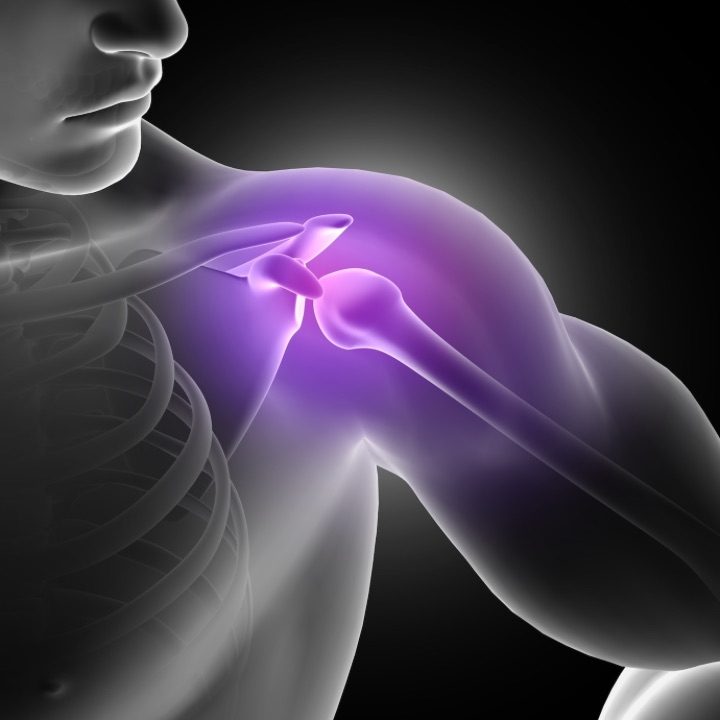 dislocated shoulder pain illustration