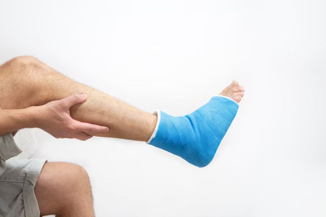 How to Manage Pain from a Fractured Ankle