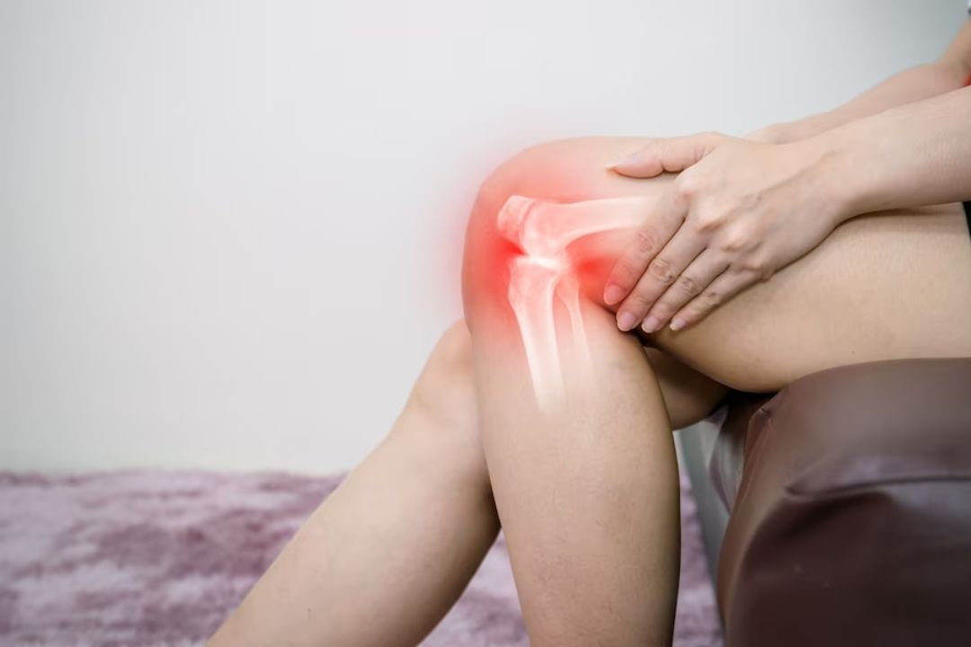 Non-Surgical Interventions to Treat Knee Bursitis