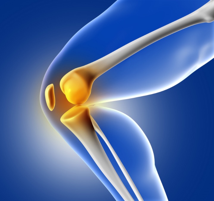 knee pain can be a symptom of plica syndrome illustration of knee pain in 3D