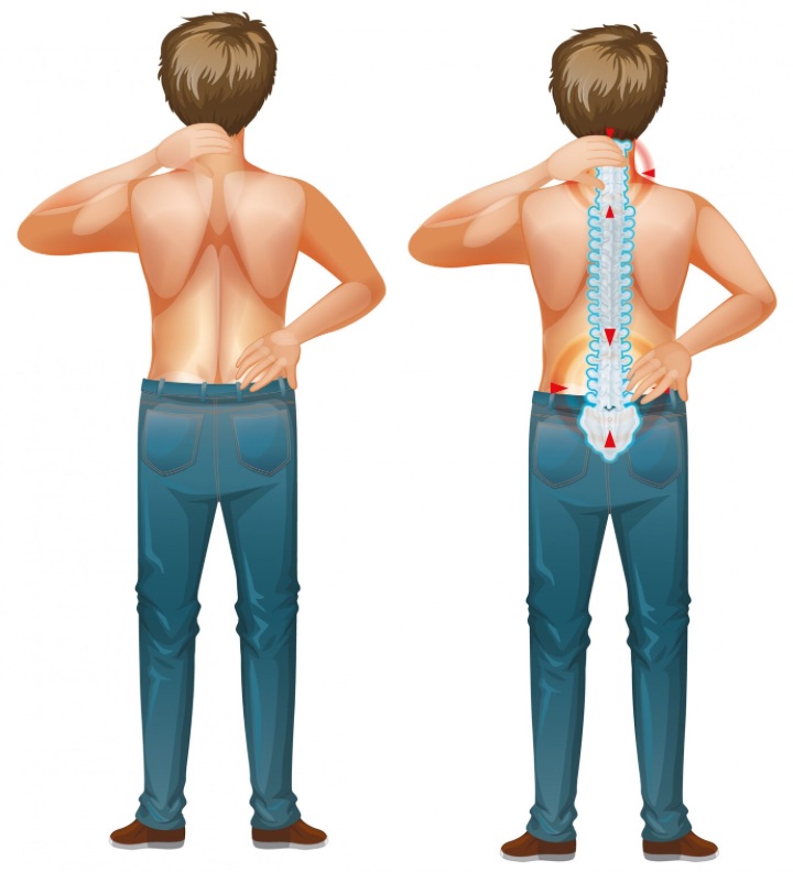 lower back pain in male human can be a sign of spondylolisthesis
