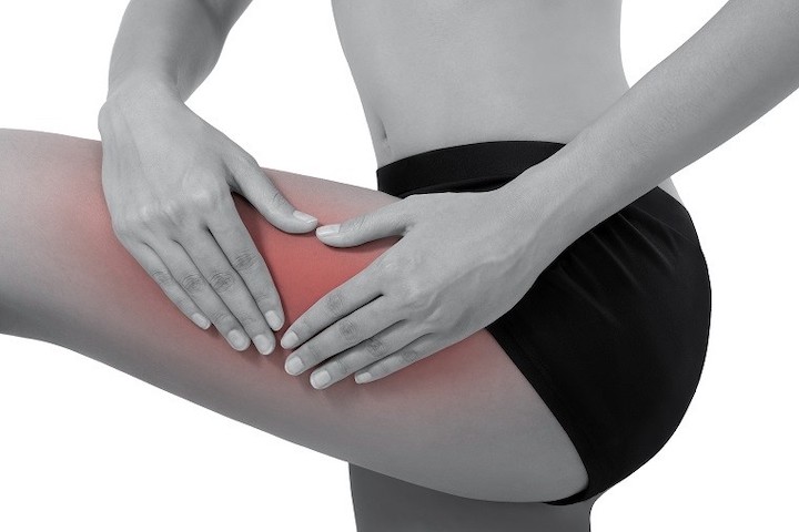 A woman pressing the side of her thigh where a red color indicates the area of pain.