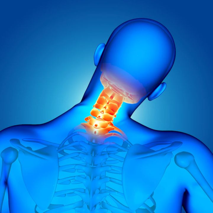 cervical facet join pain of the neck