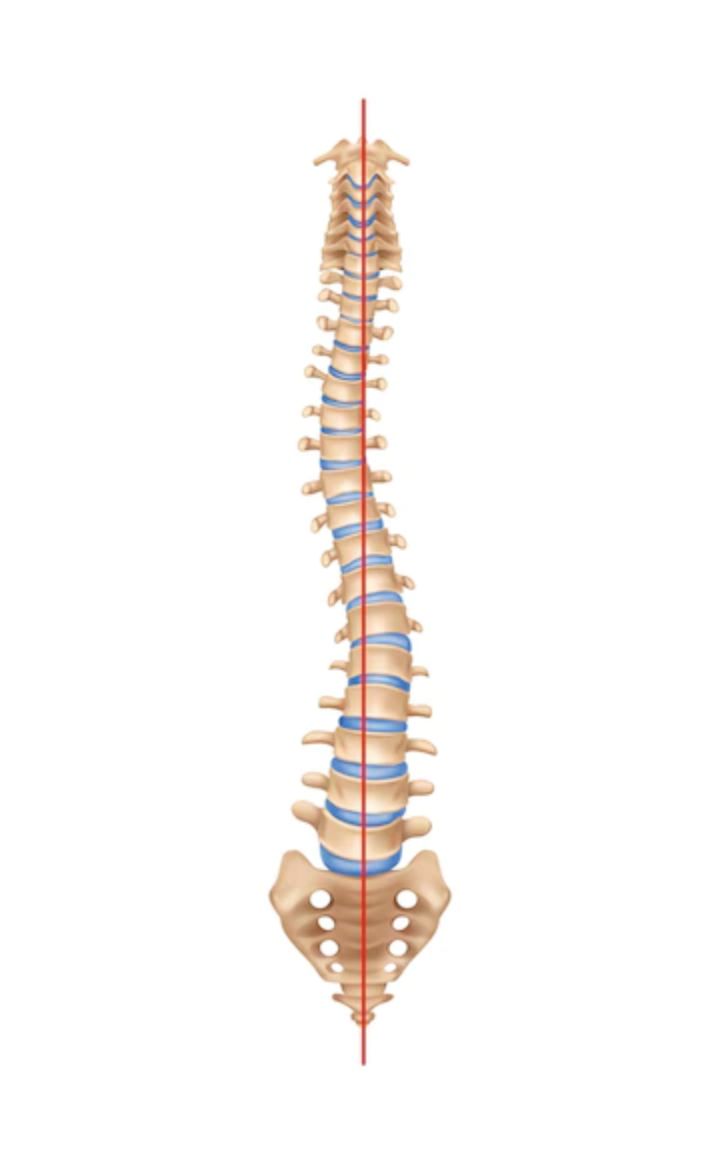 idiopathic and other causes of scoliosis