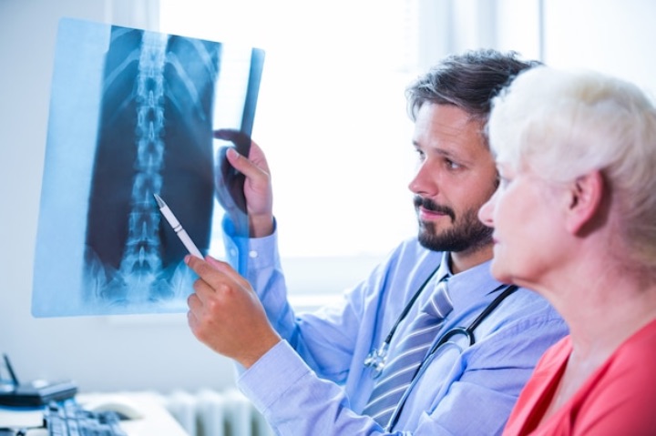 X-ray can be used to diagnose osteoporosis