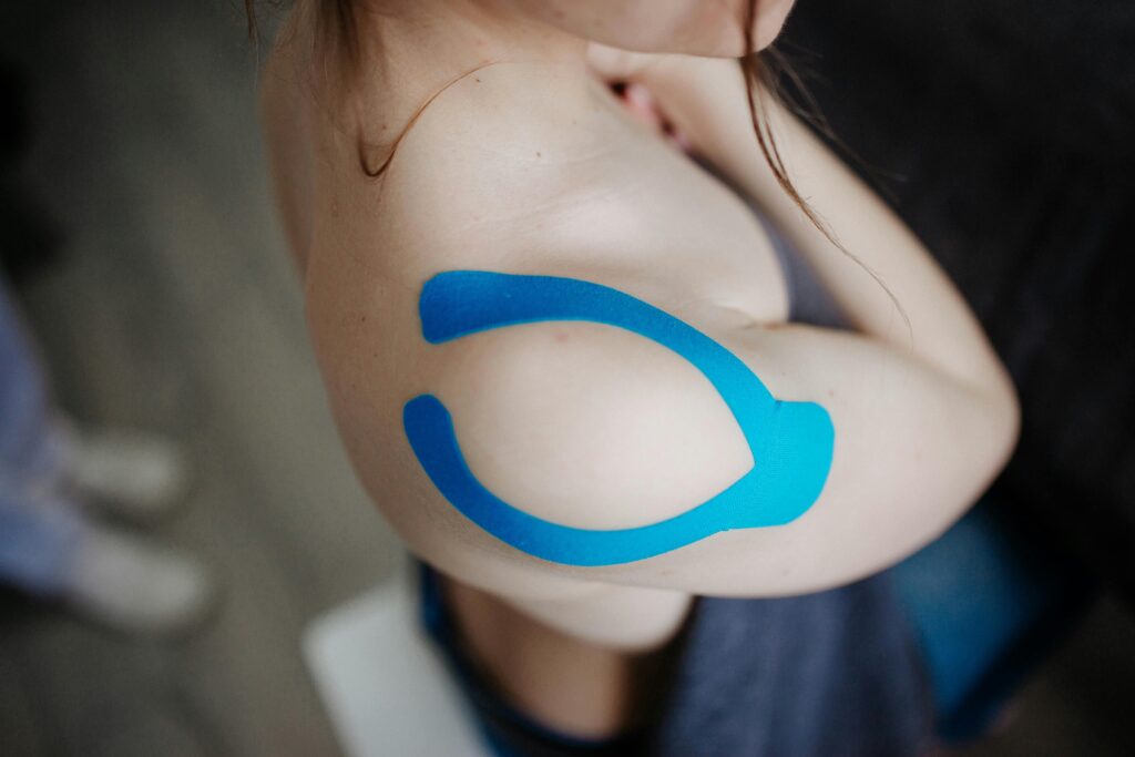 A woman with blue tape on her shoulder, representing nonsurgical treatment options for shoulder bursitis.