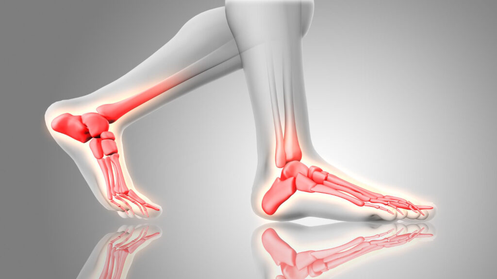 Red-highlighted foot and ankle bones, showcasing the intricate structure of the foot's skeletal system.