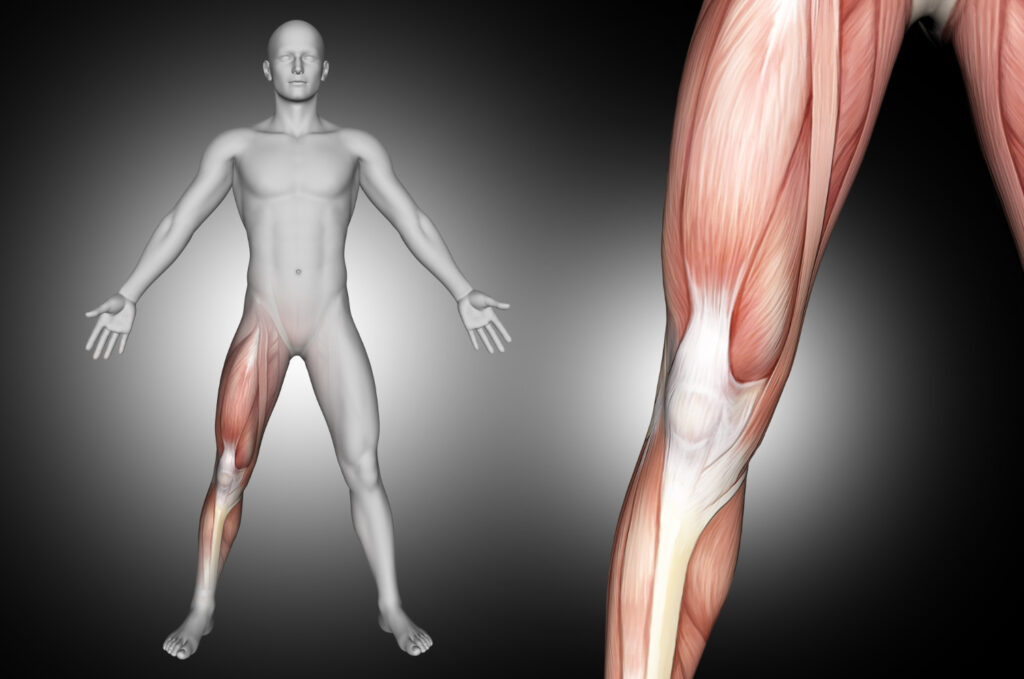 Illustration of leg muscles highlighting the tight iliacus muscle for anatomical reference.