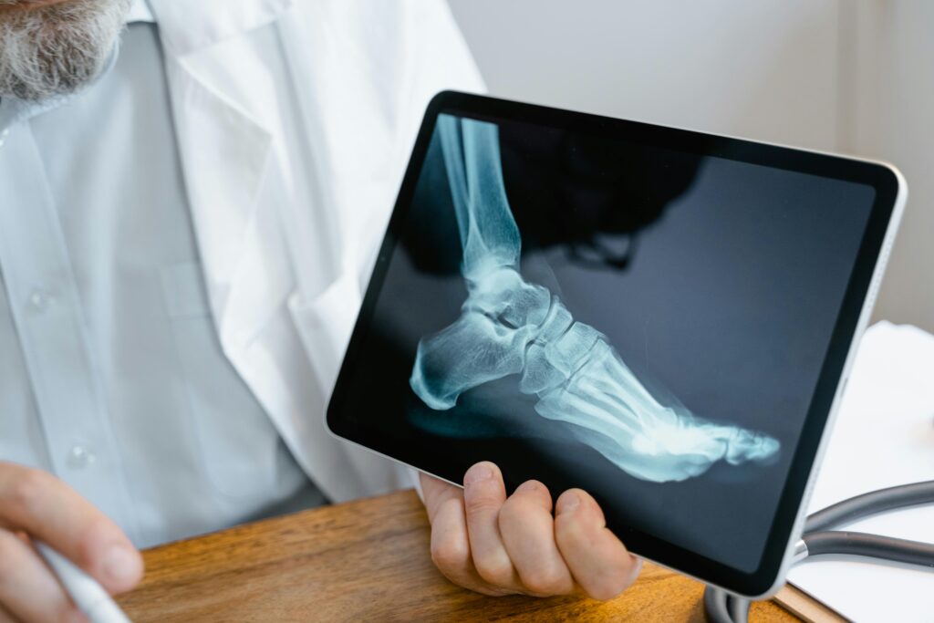 A doctor holding a tablet displaying an X-ray image that shows how many bones in a foot, highlighting the structure and alignment of the 26 bones.